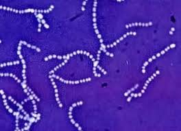 Streptococcus pyogene.jpg